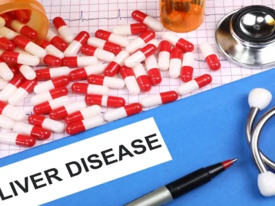 ਹੈਲਥ ਟਿਪਸ: ਫੈਟੀ ਲਿਵਰ ਦਾ ਸਾਈਲੈਂਟ ਅਟੈਕ, ਗ੍ਰੇਡ 1 ਨੂੰ 'ਨਾਰਮਲ' ਸਮਝਣਾ ਬਹੁਤ ਮਹਿੰਗਾ ਪੈ ਸਕਦਾ ਹੈ।