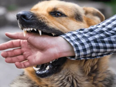 ਰੇਬੀਜ਼ ਰੋਕਥਾਮ ਸੁਝਾਅ: ਕੁੱਤੇ ਦੇ ਕੱਟਣ ਤੋਂ ਬਾਅਦ ਪਹਿਲੇ 15 ਮਿੰਟ ਬਹੁਤ ਮਹੱਤਵਪੂਰਨ ਹਨ, ਇਹ ਪਹਿਲੀ ਸਹਾਇਤਾ ਤੁਹਾਡੀ ਜਾਨ ਬਚਾ ਸਕਦੀ ਹੈ।